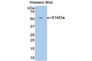 Western Blotting (WB) image for anti-Serpin Family C Member 1 (SERPINC1) (AA 159-258) antibody (ABIN3201708) (SERPINC1 抗体  (AA 159-258))