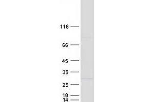 Validation with Western Blot