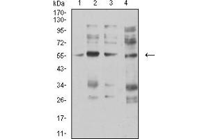 Western blot analysis using CHRNA5 mouse mAb against membrane protein lysate of C6 (1), membrane protein lysate of SK-N-SH (2), membrane protein lysate of C6 (3), and C6 (4) cell lysate. (CHRNA5 抗体  (AA 23-254))
