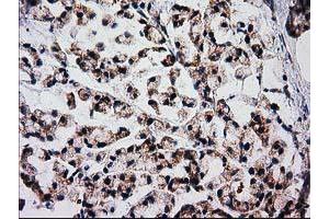 Immunohistochemistry (IHC) image for anti-Family with Sequence Similarity 127, Member C (FAM127C) antibody (ABIN1498197) (FAM127C 抗体)