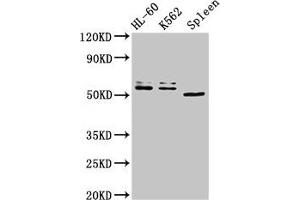 Western Blot Positive WB detected in: HL60 whole cell lysate, K562 whole cell lysate, Mouse spleen tissue All lanes: API5 antibody at 3 μg/mL Secondary Goat polyclonal to rabbit IgG at 1/50000 dilution Predicted band size: 60, 50, 57, 51, 58 kDa Observed band size: 60, 50 kDa (Apoptosis Inhibitor 5 抗体  (AA 396-524))