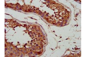 Immunohistochemistry (IHC) image for anti-Solute Carrier Family 25 (Mitochondrial Carrier, Adenine Nucleotide Translocator), Member 5 (SLC25A5) (AA 144-175) antibody (ABIN7143538)