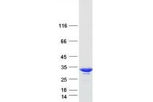 Western Blotting (WB) image for Glutathione S-Transferase omega 1 (GSTO1) protein (Myc-DYKDDDDK Tag) (ABIN2722279)