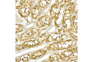 Immunohistochemistry of paraffin-embedded rat kidney using TBK1/NAK Rabbit pAb (ABIN3016267, ABIN3016268, ABIN3016269 and ABIN6219678) at dilution of 1:200 (40x lens).