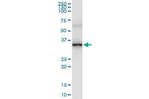 Immunoprecipitation (IP) image for anti-ATP-Binding Cassette, Sub-Family C (CFTR/MRP), Member 10 (ABCC10) (AA 1-282) antibody (ABIN529932)