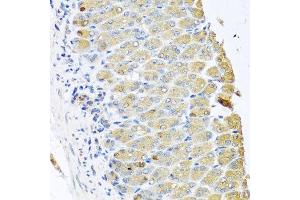 Immunohistochemistry of paraffin-embedded mouse stomach using OGFR antibody at dilution of 1:100 (x40 lens). (OGFR 抗体)