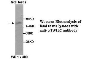 Image no. 1 for anti-Piwi-Like 2 (PIWIL2) (Internal Region) antibody (ABIN790870) (PIWIL2 抗体  (Internal Region))