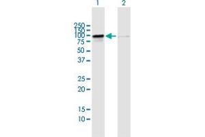 Western Blot analysis of RIOK1 expression in transfected 293T cell line by RIOK1 MaxPab polyclonal antibody. (RIOK1 抗体  (AA 1-568))