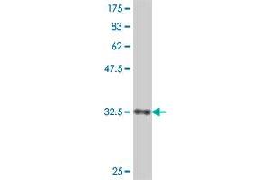Western Blotting (WB) image for anti-Nuclear Receptor Subfamily 2, Group F, Member 2 (NR2F2) (AA 153-240) antibody (ABIN563161)
