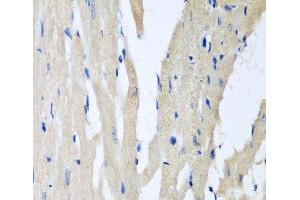 Immunohistochemistry of paraffin-embedded Rat heart using PITRM1 Polyclonal Antibody at dilution of 1:100 (40x lens). (PITRM1 抗体)