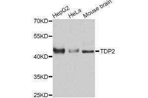 Western blot analysis of extracts of various cell lines, using TDP2 Antibody. (TDP2 抗体)