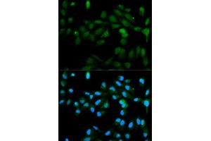 Immunofluorescence analysis of MCF7 cell using CYP11A1 antibody. (CYP11A1 抗体)