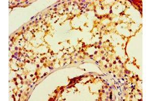 Immunohistochemistry of paraffin-embedded human testis tissue using CHRFAM7A Antibody at a dilution of 1:100. (CHRFAM7A 抗体  (AA 1-150))