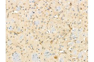 ABIN6259458 and ABIN6275227 at 1/100 staining Mouse brain tissue by IHC-P. (MBTPS1 抗体  (Internal Region))