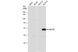 WB Image KLF15 antibody [N1], N-term detects KLF15 protein by western blot analysis. (KLF15 抗体  (N-Term))
