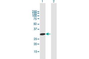 Western Blot analysis of ADAL expression in transfected 293T cell line by ADAL MaxPab polyclonal antibody. (ADAL 抗体  (AA 1-267))