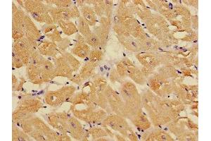 Immunohistochemistry of paraffin-embedded human heart tissue using ABIN7173569 at dilution of 1:100 (TNNC1 抗体  (AA 11-149))