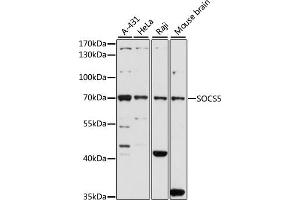 Western blot analysis of extracts of various cell lines, using SOCS5 antibody (ABIN6128734, ABIN6148271, ABIN6148272 and ABIN6223959) at 1:1000 dilution. (SOCS5 抗体  (AA 1-140))