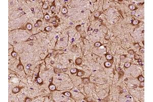 Paraformaldehyde-fixed, paraffin embedded Mouse brain Antigen retrieval by boiling in sodium citrate buffer (pH6. (ALOX5 抗体  (AA 601-674))