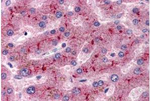 Human Liver (formalin-fixed, paraffin-embedded) stained with CFH antibody ABIN337307 at 2. (Complement Factor H 抗体  (AA 577-588))