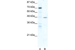 WB Suggested Anti-NR2F6 Antibody Titration:  5. (NR2F6 抗体  (Middle Region))