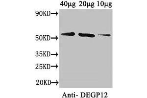 Western Blot Positive WB detected in: Arabidopsis thaliana (40 μg, 20 μg, 10 μg) All lanes: DEGP12 antibody at 3. (DEGP12 抗体  (AA 25-499))