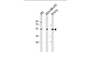 All lanes : Anti-ENT1(Slc29a1)-Ps254 at 1:500-1000 dilution Lane 1: 293 whole cell lysate Lane 2: MDA-MB-453 whole cell lysate Lane 3: Mouse lung tissue lysate Lysates/proteins at 20 μg per lane. (SLC29A1 抗体  (AA 232-260))