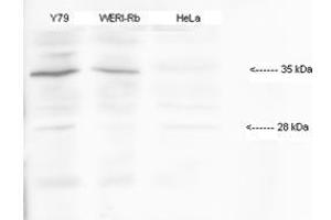 Human; HMX1 antibody - middle region validated by WB using Y79, WERI-(human retinoblastoma cell lines), HeLa-(human papilloma virus cell line) at 1:1000. (HMX1 抗体  (Middle Region))