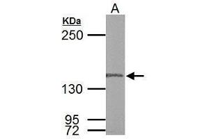 Western Blotting (WB) image for anti-Polymerase (DNA Directed), gamma (POLG) (C-Term) antibody (ABIN2854742)