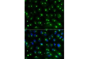 Immunofluorescence analysis of MCF-7 cells using GGA2 antibody. (GGA2 抗体)