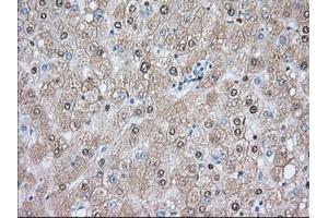 Image no. 1 for anti-Acetyl-CoA Acetyltransferase 2 (ACAT2) antibody (ABIN1496398) (ACAT2 抗体)