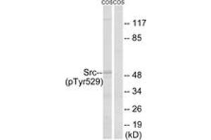 Western blot analysis of extracts from COS7 cells treated with PMA 125ng/ml 30', using Src (Phospho-Tyr529) Antibody. (Src 抗体  (pTyr530))