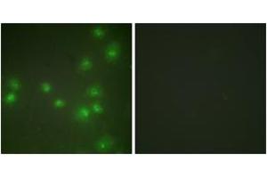 Immunofluorescence analysis of HuvEc cells, using ZNF265 Antibody. (ZNF265 抗体  (AA 106-155))