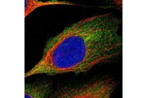 Immunofluorescent staining of U-2 OS cells with ITGB2 polyclonal antibody  (Green) shows localization to cytosol.
