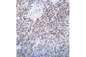 Immunohistochemistry analysis in formalin fixed and paraffin embedded human spleen tissue reacted with PATL2 Antibody (Center) followed which was peroxidase conjugated to the secondary antibody and followed by DAB staining.