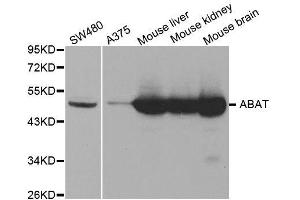 Western blot analysis of extracts of various cell lines, using ABAT antibody. (ABAT 抗体  (AA 29-300))