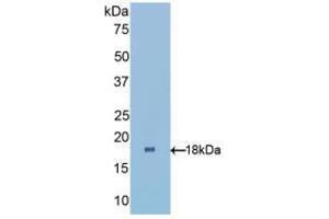 Western blot analysis of recombinant Human RBP1. (RBP1 抗体  (AA 2-135))