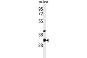 Western Blotting (WB) image for anti-Enoyl CoA Hydratase Domain Containing 1 (ECHDC1) antibody (ABIN3004267) (ECHDC1 抗体)