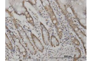 Image no. 2 for anti-V-Akt Murine Thymoma Viral Oncogene Homolog 2 (AKT2) (AA 100-189) antibody (ABIN599349) (AKT2 抗体  (AA 100-189))