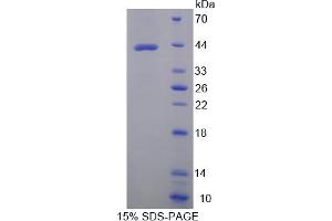 SDS-PAGE analysis of Human AST2 Protein. (GOT2 蛋白)