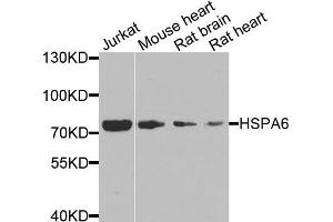Western blot analysis of extracts of various cell lines, using HSPA6 antibody. (HSPA6 抗体)
