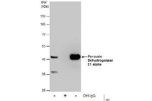 IP Image Immunoprecipitation of Pyruvate Dehydrogenase E1 alpha protein from HepG2 whole cell extracts using 5 μg of Pyruvate Dehydrogenase E1 alpha antibody, Western blot analysis was performed using Pyruvate Dehydrogenase E1 alpha antibody, EasyBlot anti-Rabbit IgG  was used as a secondary reagent. (Pyruvate Dehydrogenase E1 alpha (Center) 抗体)