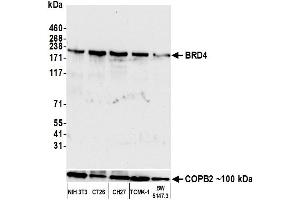 Western Blotting (WB) image for anti-Bromodomain Containing 4 (BRD4) (AA 1312-1362) antibody (ABIN7454019)