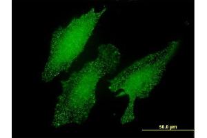 Immunofluorescence of monoclonal antibody to LMO3 on HeLa cell.