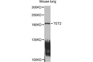 Western blot analysis of extracts of mouse lung, using TET2 antibody (ABIN1875061) at 1:1000 dilution. (TET2 抗体)