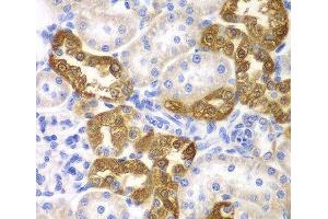 Immunohistochemistry of paraffin-embedded Rat kidney using CD151 Polyclonal Antibody at dilution of 1:200 (40x lens). (CD151 抗体)