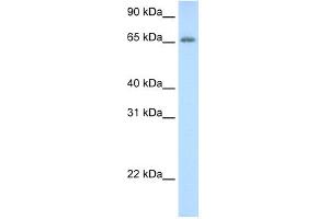 WB Suggested Anti-ADAT1 Antibody Titration:  0.