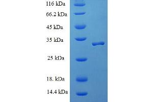 SDS-PAGE (SDS) image for Ionized Calcium-binding Adapter Molecule 1 (IBA1) (AA 2-147), (partial) protein (His-SUMO Tag) (ABIN5709019)