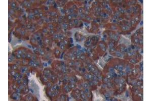 DAB staining on IHC-P; Samples: Rat Adrenal gland Tissue (COL3A1 抗体  (AA 1171-1435))