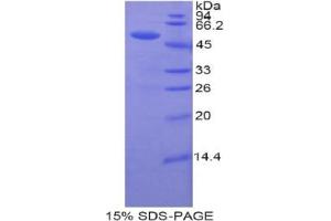 Uracil Phosphoribosyltransferase (UPP) 蛋白